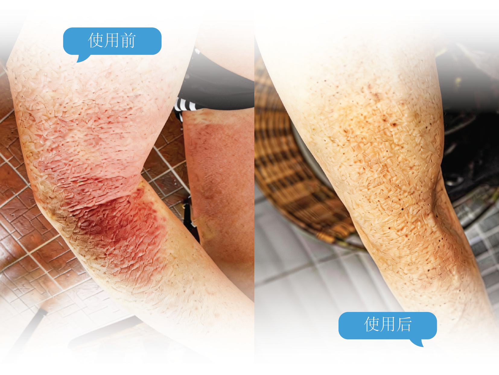 before & after cn-01