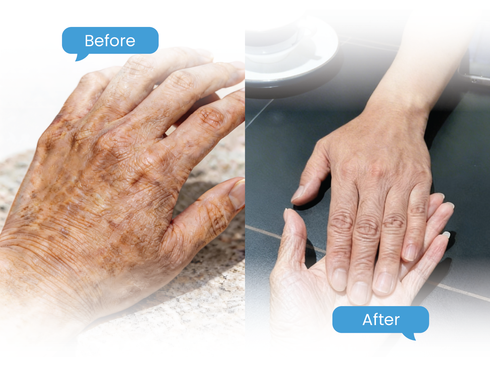 before & after hand 2-01