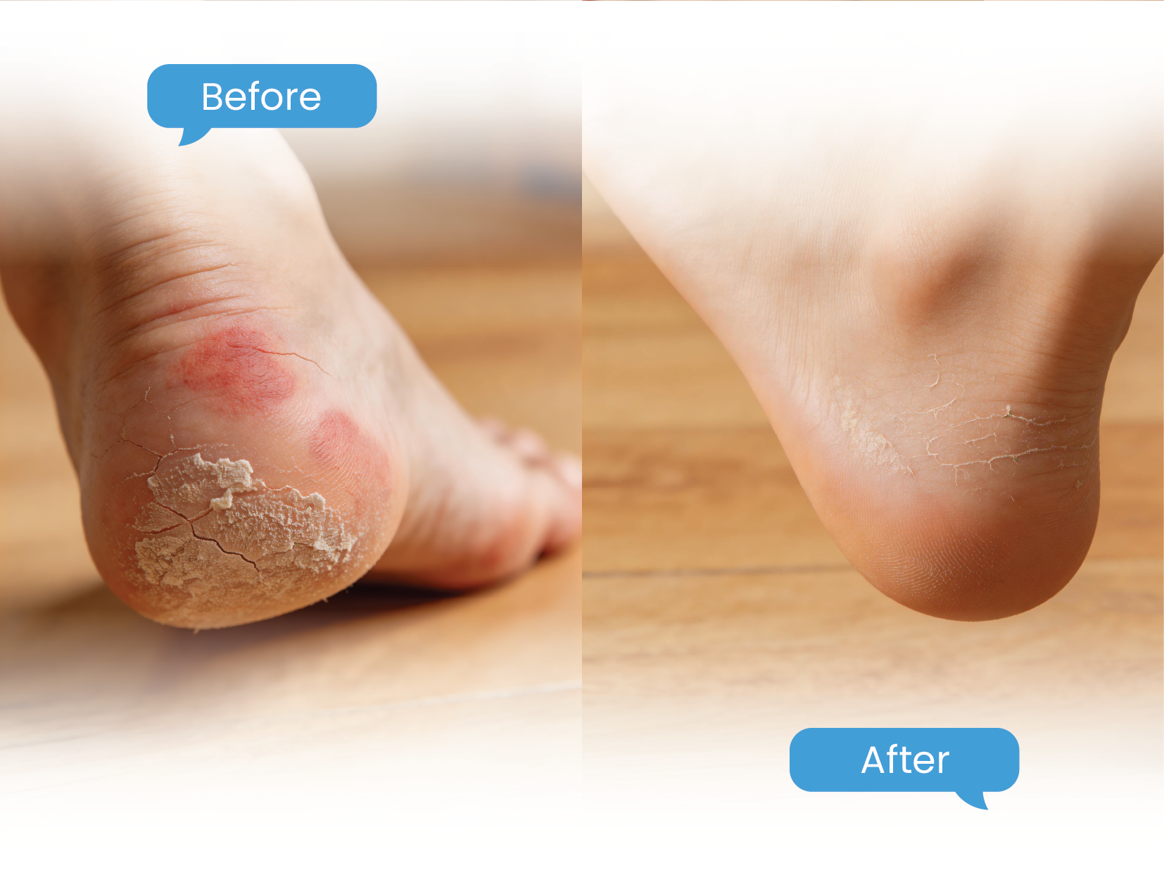 before & after leg-01